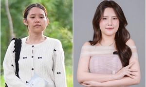 20 năm giấu mình sau khẩu trang và kỳ tích 'tái sinh' của cô gái Đà Lạt