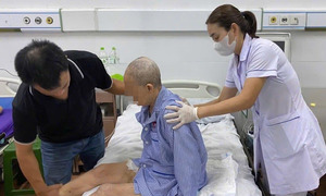 Mắc thủy đậu tự điều trị tại nhà, người già viêm não, người trẻ suy hô hấp