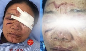 Sức khỏe người phụ nữ bị xịt vòi nước cao áp ở Phú Thọ ra sao?
