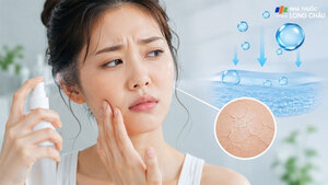 5 lý do da bạn vẫn khô căng dù xịt khoáng thường xuyên