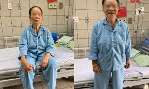 Đỉnh cao kỹ thuật khi thực hiện đại phẫu ung thư dạ dày với vết rạch vài milimet
