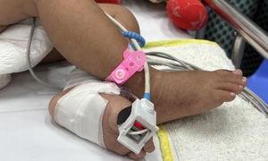 Bệnh hô hấp vào mùa, trẻ nhập viện gia tăng tại TP.HCM