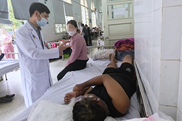 Cảnh báo tai nạn do pháo nổ dịp cận Tết