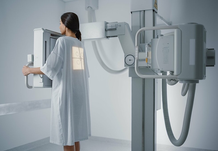 Bộ Y tế: Chụp X-quang đủ 6 phút không phải căn cứ duy nhất để trả bảo hiểm y tế