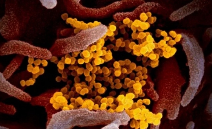 Biến thể COVID-19 "Ve sầu" né vaccine, lây nhanh tại Mỹ: Bộ Y tế cảnh báo gì?