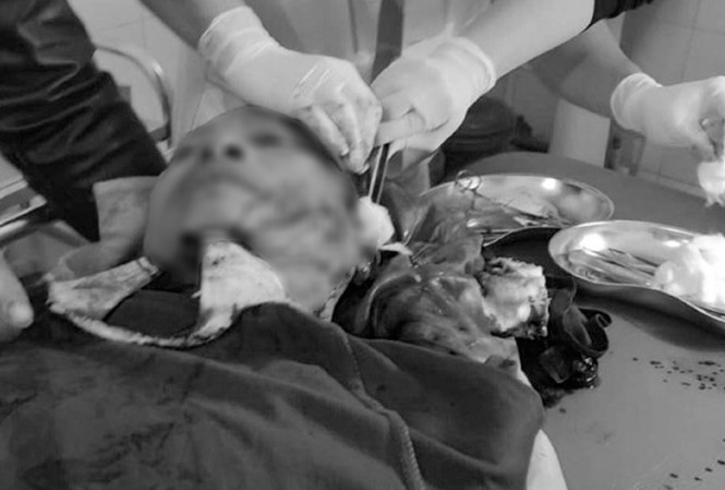 Con trai gây mâu thuẫn, bố bị chém trọng thương - 1