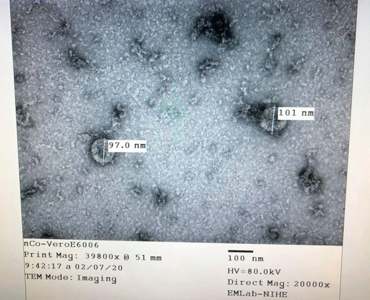 Việt Nam nuôi cấy thành công virus corona mới - 1