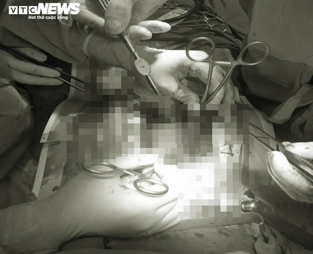 Cứu sống kịp thời người phụ nữ bị vỡ tim do tai nạn giao thông - 1