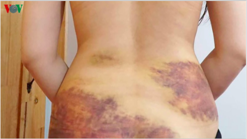 Chồng đánh vợ dã man ở Tây Ninh do ghen tuông - 1