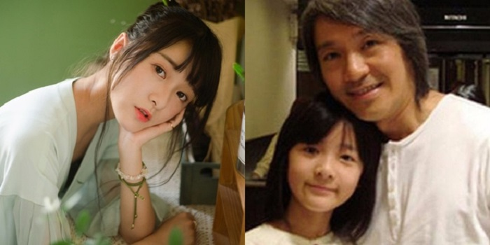 Con gái nuôi của Châu Tinh Trì mặt biến dạng vì thẩm mỹ - 2