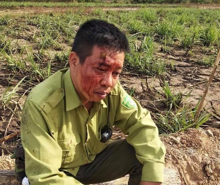 Lâm tặc đánh kiểm lâm toác đầu: Bí thư Đắk Lắk chỉ đạo xử lý nghiêm - 1