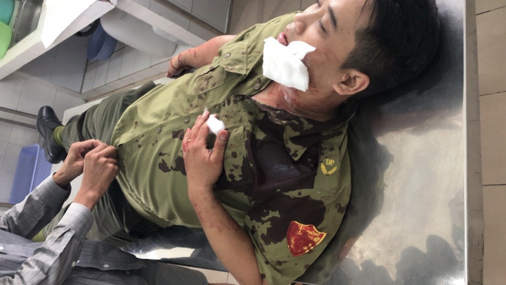 Một dân phòng bị đâm chết trong trụ sở công an phường ở Bình Dương - 1