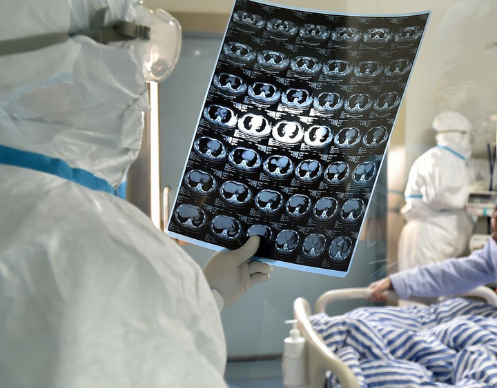 Trung Quốc: Bệnh nhân nhiễm nCoV sau 8 lần xét nghiệm âm tính - 1