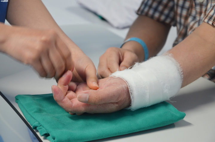 Ghép tay từ người cho còn sống - ca phẫu thuật đỉnh cao 'chưa từng có trong y văn' của bác sĩ Việt Nam - 2