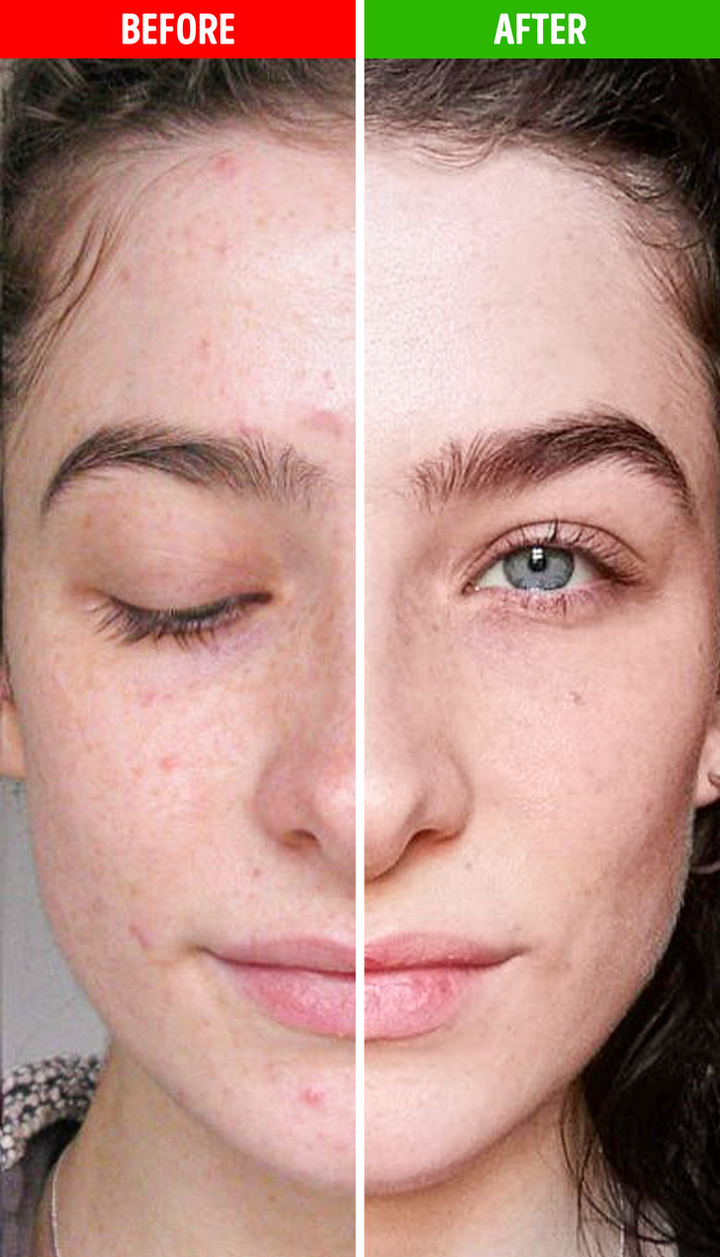 Chuyện gì xảy ra với cơ thể nếu ăn đu đủ hàng ngày? - 4