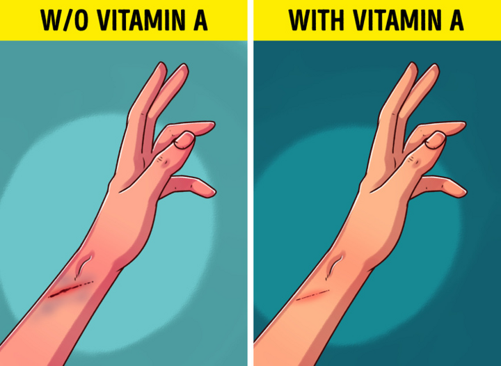 7 dấu hiệu cho thấy bạn đang bị thiếu vitamin A - 5