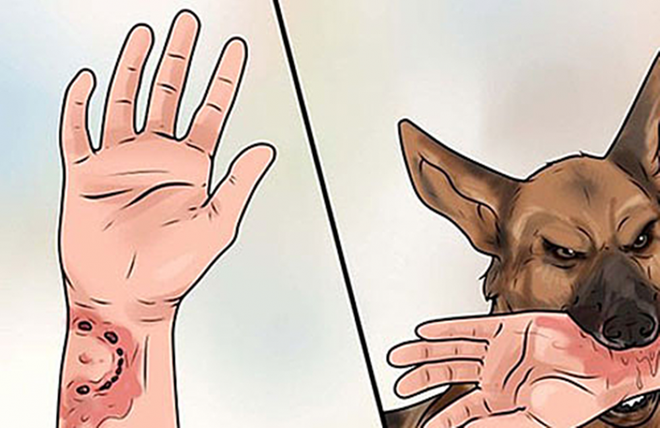 Bé gái 6 tuổi ở Tuyên Quang bị chó nhà nuôi cắn rách mặt - 1