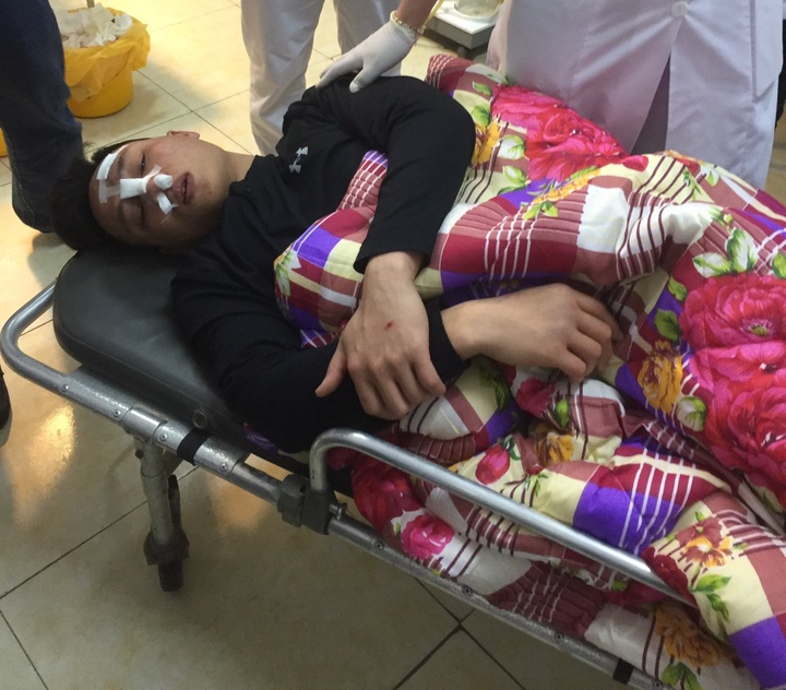 Bác sĩ ở Hải Dương bị đánh gãy sống mũi: Triệu tập 7 nghi phạm - 1