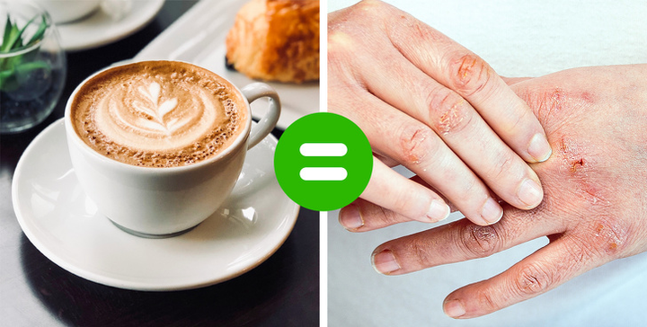 8 thực phẩm gây tình trạng lão hóa nhanh nếu ăn nhiều - 7