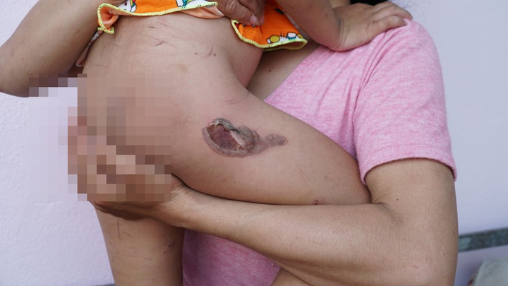 Bắt giam gã cha dượng bạo hành, dí con riêng của vợ vào bô xe máy - 1