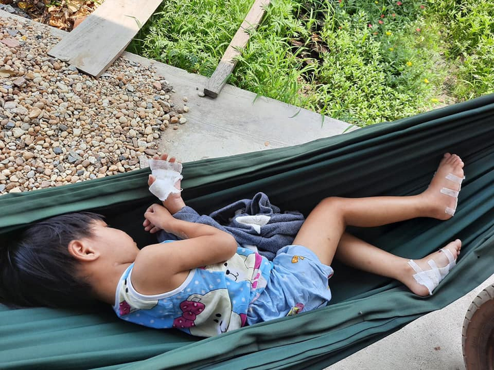 Cha dượng bạo hành dã man bé gái 4 tuổi: Tỉnh Tây Ninh chỉ đạo xử nghiêm - 1