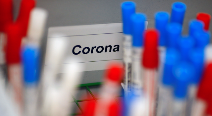 Nga nghiên cứu thành công 3 loại thuốc có thể giúp điều trị Covid-19 - 1