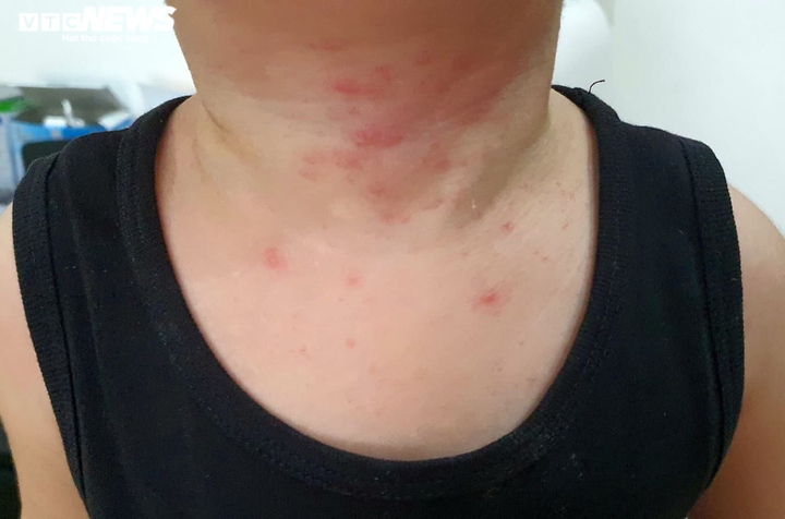 Ban quản lý tự mua hóa chất phun khử khuẩn, cư dân kêu dị ứng, nôn mửa - 1