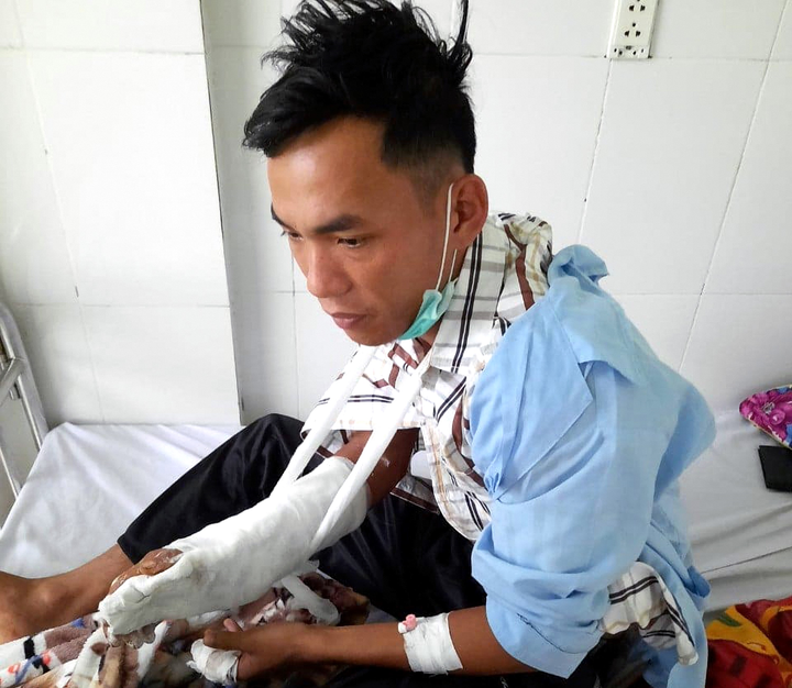 Cán bộ bảo vệ rừng bị chém trọng thương - 1