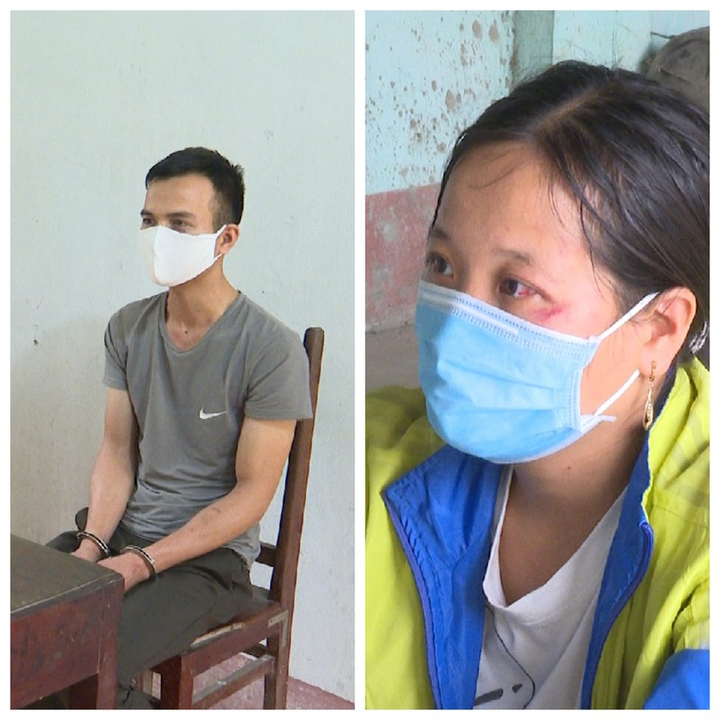 Chăn nuôi thất bát, hai vợ chồng rủ nhau trộm 16 xe máy - 1