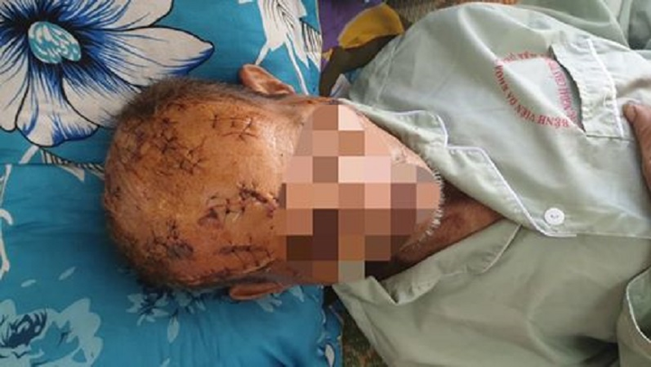 Nghi vấn ông lão 74 tuổi bị con, cháu rạch nát đầu vì tranh giành đất đai - 1