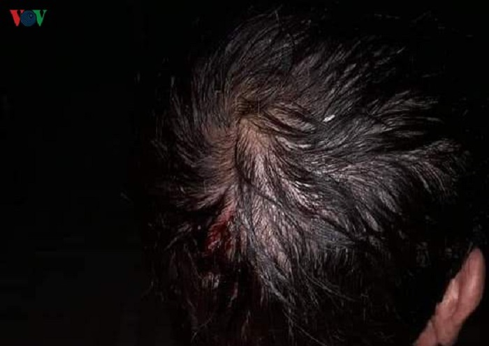 Mưa đá khổng lồ dội xuống xã biên giới Lai Châu, hàng trăm ngôi nhà tan hoang - 13