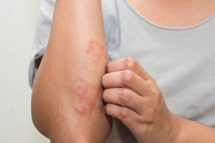 Tác dụng không ngờ của quả đu đủ với sức khỏe và hệ miễn dịch - 4