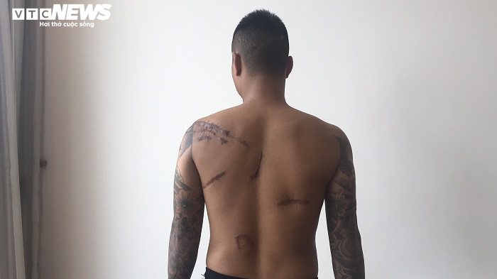 Nghi vấn đàn em Đường Dương truy sát nam thanh niên lúc nửa đêm rồi vứt xuống hố - 1