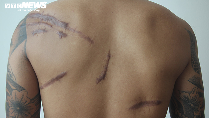 Nghi vấn đàn em Đường Dương truy sát nam thanh niên lúc nửa đêm rồi vứt xuống hố - 3