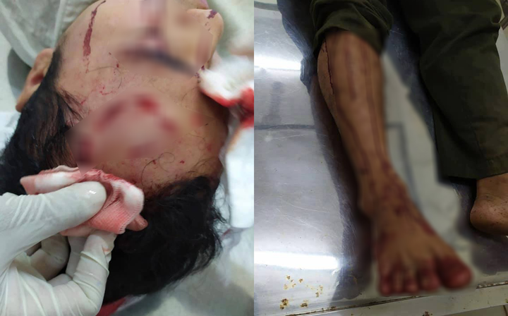 Đang ở trụ sở, kiểm lâm viên bị 10 tên côn đồ xông vào đánh trọng thương - 1