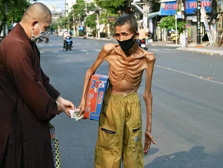 Tìm thấy tung tích người đàn ông da bọc xương: Chỗ ở 7m2, không thể tự đi đứng - 1