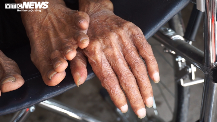 Tìm thấy tung tích người đàn ông da bọc xương: Chỗ ở 7m2, không thể tự đi đứng - 3