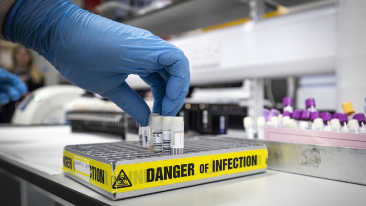 Các nước đối phó với ca mắc COVID-19 dương tính trở lại thế nào? - 3