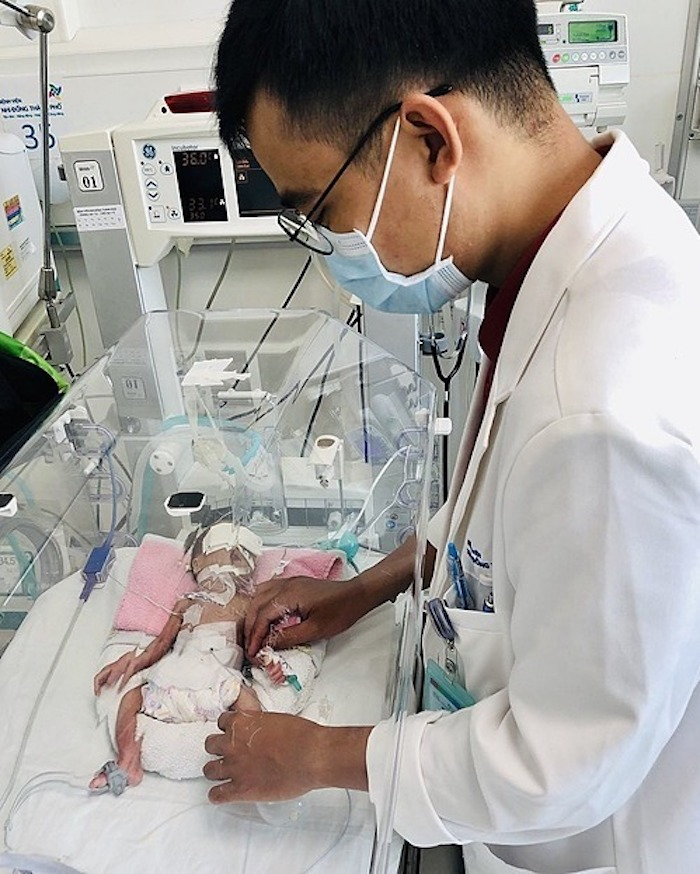 Bé nặng 1,2kg được phẫu thuật ruột thành công - 1