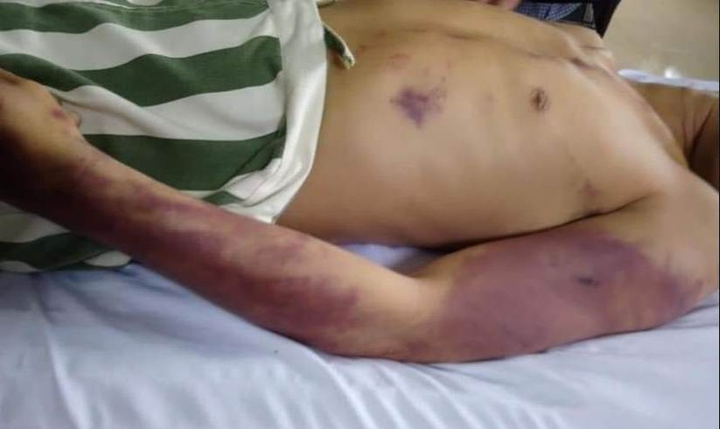 Phạm nhân bị đánh chết ở huyện Châu Đức: Kiểm soát đột xuất nhà tạm giữ - 1