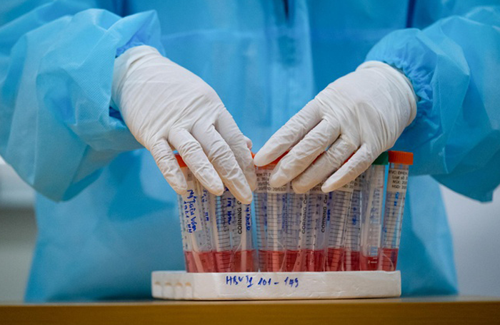 Bệnh nhân 91 phi công người Anh chỉ còn 10% phổi hoạt động - 1