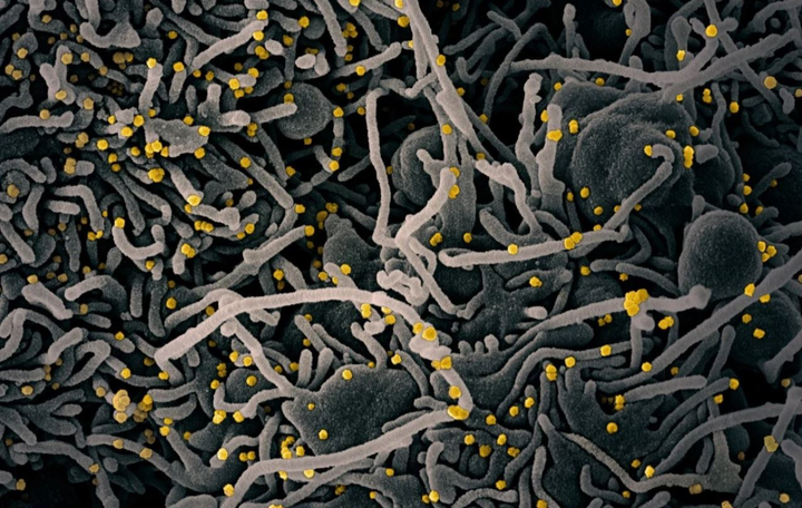 Chuyên gia Trung Quốc xác nhận từng hủy mẫu virus corona mới - 2