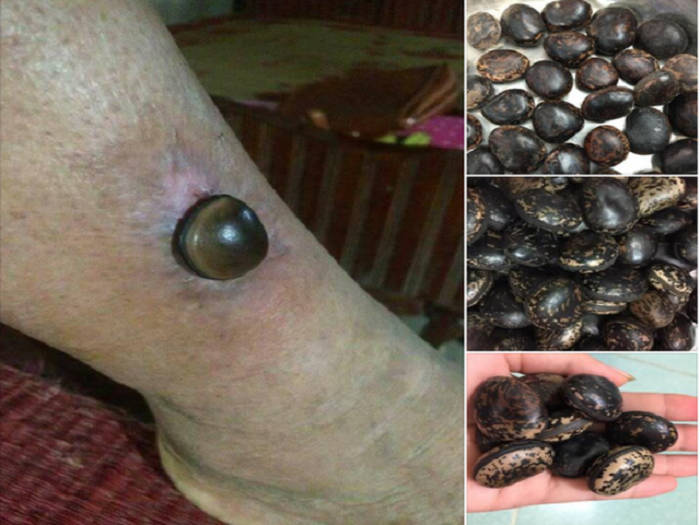 Sự thật về 'thần dược' hạt đậu Lào giá 'cắt cổ' 6 triệu đồng/kg - 3