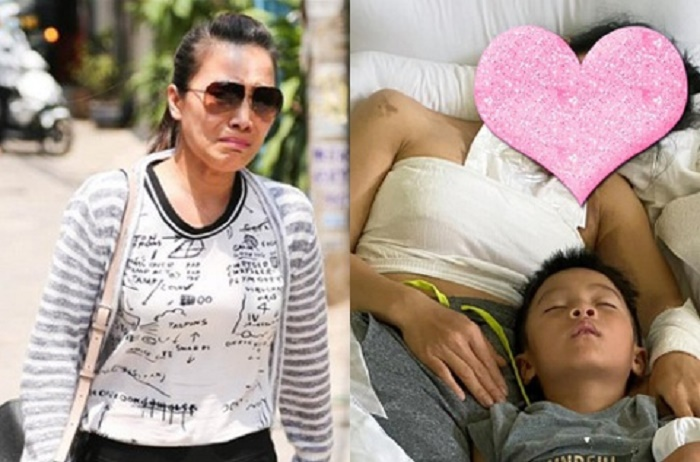 Ca sĩ Hồng Ngọc bắt đầu thay da sau khi bị bỏng vì nổ nồi xông hơi - 1