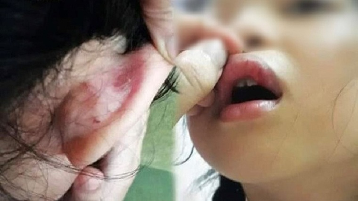 Phụ huynh tố cô giáo đánh con vì làm bài sai: Công an vào cuộc - 2