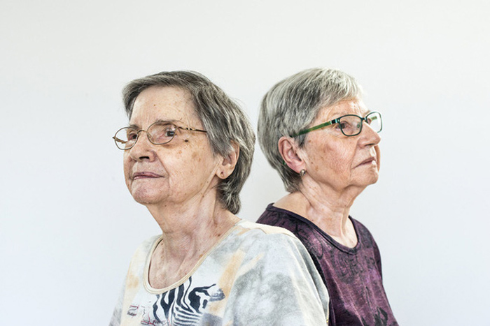 Cuộc đời bất hạnh của 5 chị em sinh đôi từng bị gọi là 'kỳ quan thứ 8' - 6