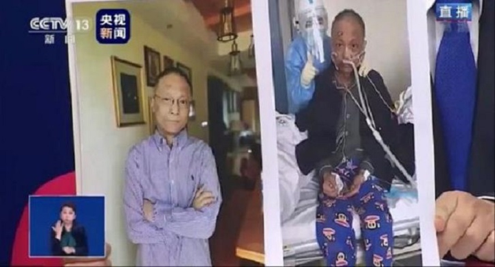 Trái chiều số phận 2 bác sỹ Vũ Hán cùng bị đổi màu da vì COVID-19 - 2