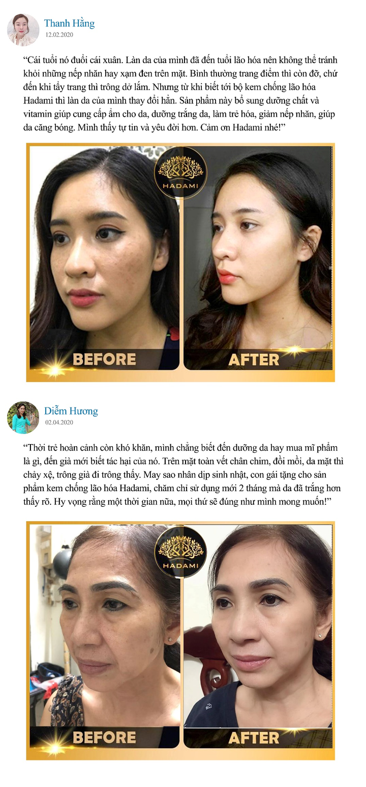 Bước vào cuộc chiến chống lão hóa da: Ai nhanh người đó thắng - 6