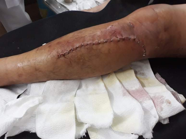 Hiệp sĩ bị đánh gãy chân vì lấy lại tài sản cho dân: Vì sao chưa khởi tố? - 1