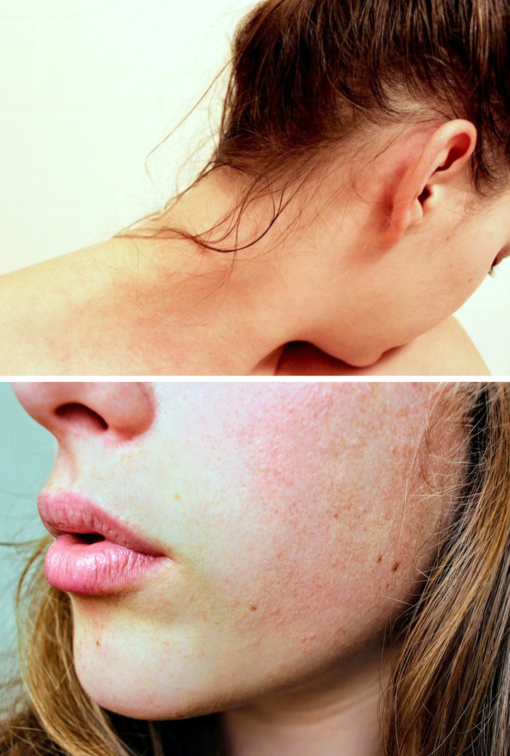 6 lý do để bỏ thói quen đi ngủ khi tóc còn ướt - 6